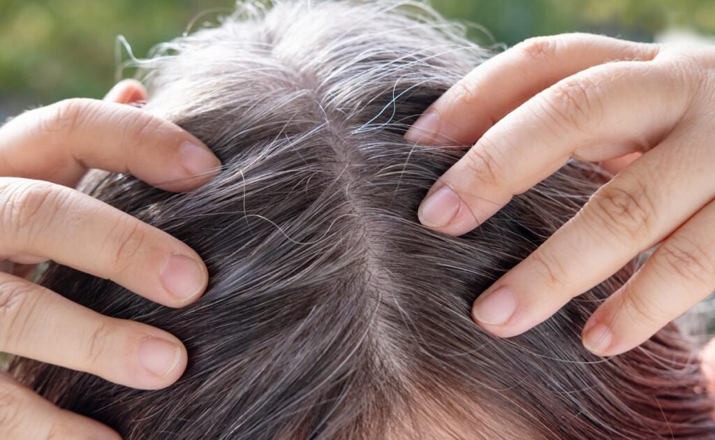 बच्चों के बाल कम उम्र में सफेद क्यों हो रहे? जानिए कारण और बचाव White hair